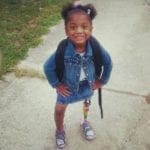 Exciting New Development in Pediatric Prosthetics